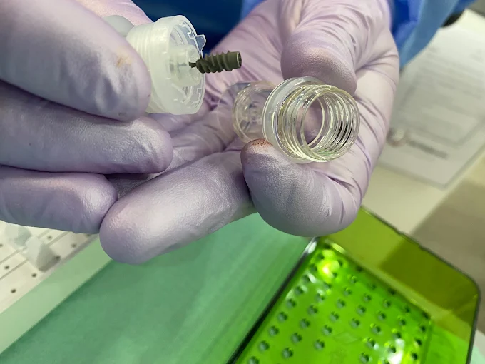 Mostra implant dentar