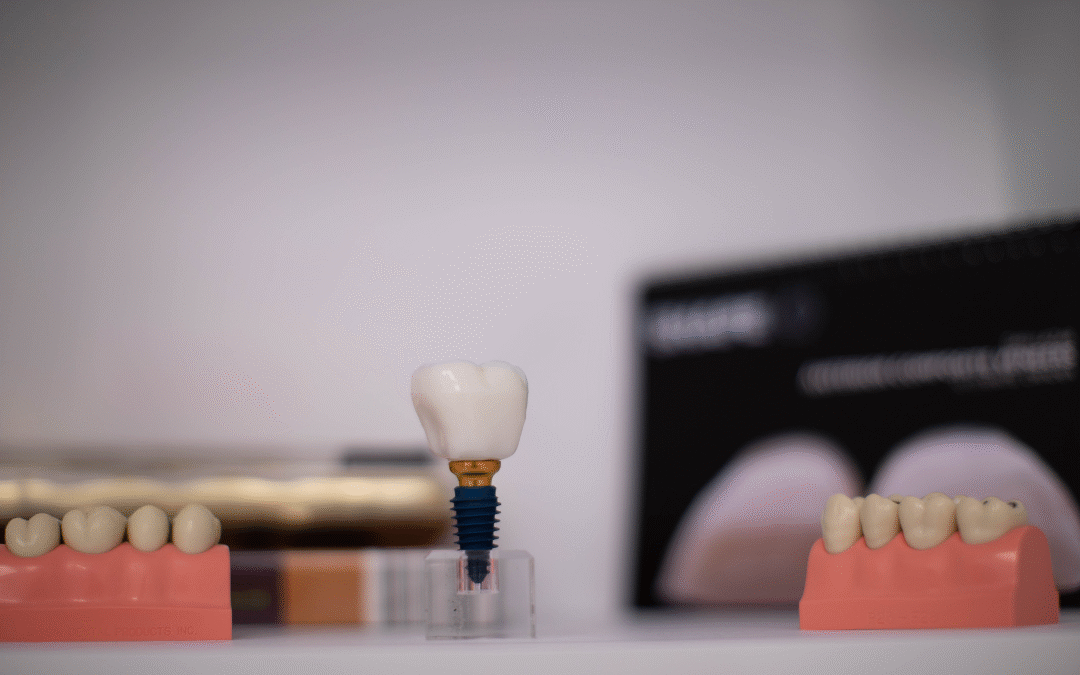 Implant dentar în Satu Mare – cât costă și de ce diferă prețurile?